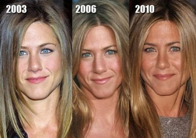 Jennifer-Aniston-nose-job-2003-2010